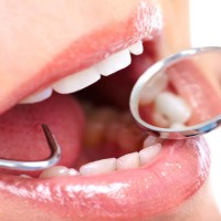 For Improved Happiness, See A Cosmetic Dentist in Queens, NY