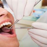 Simple Preparation Tips for an Initial Visit to a Dentist in Keizer, OR