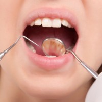 Four Steps To Finding A Great Dentist
