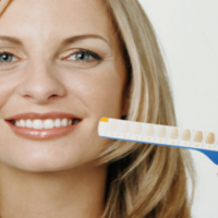 Frequently Asked Questions About Professional Teeth Whitening At A Dental Clinic
