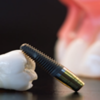 What Are The Benefits Of Family Dentistry in Garden City, NY?