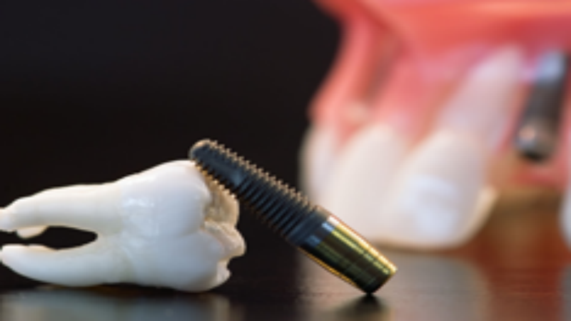 What Are The Benefits Of Family Dentistry in Garden City, NY?