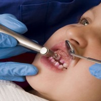 Dental Implants In Waukesha WI Can Permanently Replace Missing Teeth