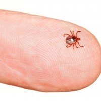 When It Comes to Bed Bugs Jackson NJ Pest Control Specialists Can Help