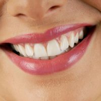 Types Of Gum Disease Treatment Available In Adelaide