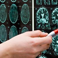 Importance of Diagnostic Exams like Radiology Imaging