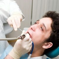 Choosing a Dentist Annapolis
