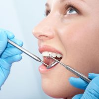Reasons to Get a Tooth Filling in Midwest City, OK