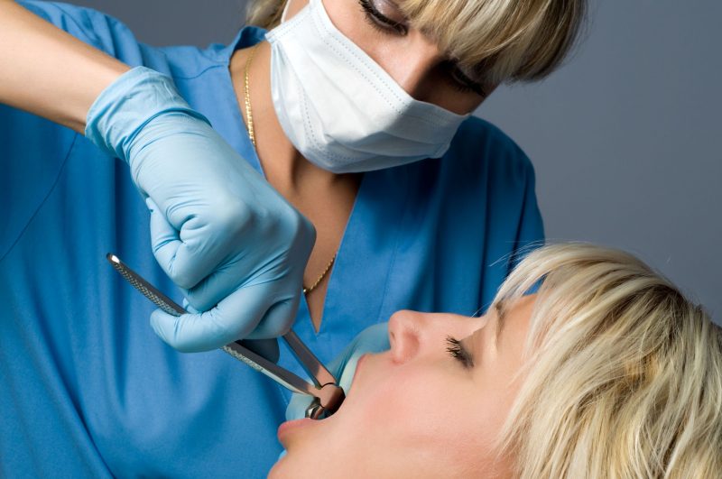 Wisdom Teeth Removal Is Accomplished With Oral Surgery in Fishers IN