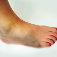 Finding Foot Doctors in Kenosha, WI