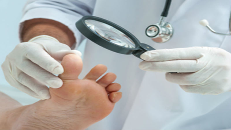 Advice from a Foot Surgeon in Racine WI: Important Things to Know Before Surgery