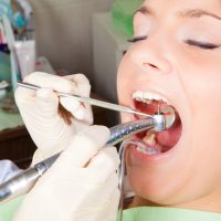 3 Reasons That Getting Burlington Dentures May Be Right For You