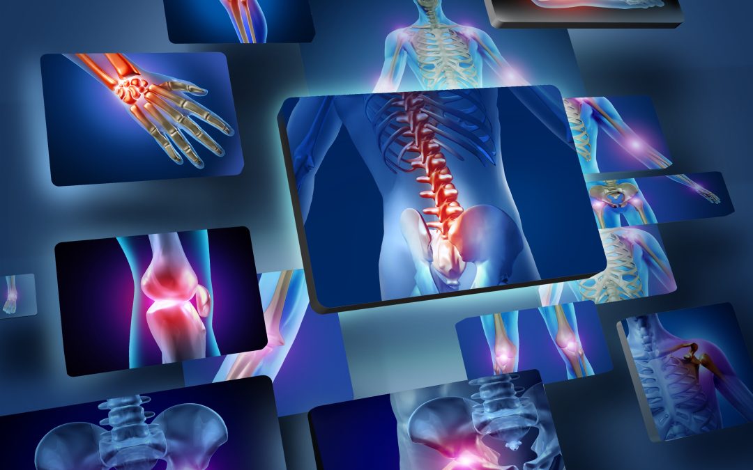 Simple Strategies to Ease Sciatica in Little Rock, AR for Lasting Relief at Home
